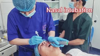 Nasotrachial intubation and Extubation a patient performed mandibular fixation [upl. by Amsed]