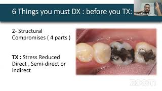 Biomimetic Restorative Dentistry  The six lessons approachDrHaider Waleed biomimetic [upl. by Yelrak]