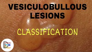 VESICULOBULLOUS LESIONS CLASSIFICATION [upl. by Ajit333]