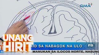 Unang Hirit Ano ang dapat gawin kapag nauntog o nabagok ang ulo [upl. by Eynenihc]