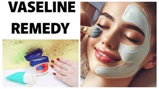 Vaseline ky fayde  Vaseline hacks  Vaseline skin whitening remedy by beauty with knowledge [upl. by Lefty]