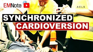 Synchronized Cardioversion [upl. by Prudi148]