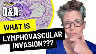 What is Lymphovascular Invasion  Breast Cancer  Dr Liz ORiordan [upl. by Massab]