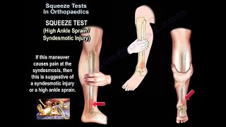 Squeeze Test In Orthopaedics  Everything You Need To Know  Dr Nabil Ebraheim [upl. by Kurman229]