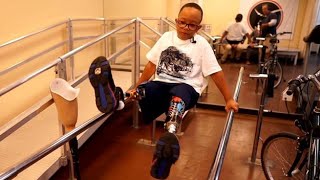 Prosthetist Makes Customized Artificial Limbs For Children Of All Economic Means [upl. by Cliffes718]