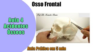 Osso Frontal  Aula Prática  Acidente Ósseo  Parte 4 [upl. by Latif307]