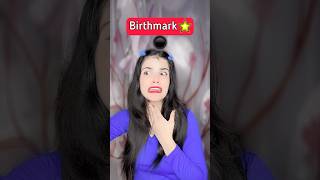 You Have Choose Between 1 Lakh Rupees Or Birthmark🤫 shorts youtubeshorts funny [upl. by Adan457]