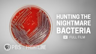 When Antibiotics Dont Work full documentary  FRONTLINE [upl. by Eveneg584]