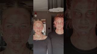 Measles viralvideo makeuptutorial creepy scary [upl. by Atiniv168]