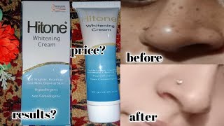 hitone whitening cream  best medicated cream for skin brightening amp freckles  pigmentation [upl. by Yssac]