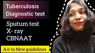 Tuberculosis Diagnosis  CBNAAT  Sputum test  X ray  tuberculosis diagnosis cbnaat [upl. by Annaerda]