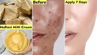 Indian👆🏼Skin Whitening CreamBest Multani Mitti CreamTo Get Clear Smooth Fair Bright SkinCHALLENGE [upl. by Walden]