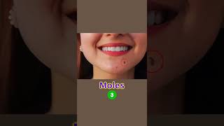 How to manage moles amp open pore Skin Care Tips  Dr Sarin [upl. by Norahc134]