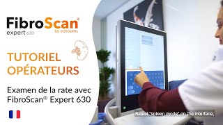 FibroScan® Expert 630  Tutoriel mesure de lélasticité de la rate [upl. by Gebelein534]