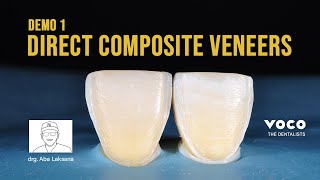 Step by Step Direct Composite Veneers Restoration with 2 Layers Technique using AMARIS  VOCO GmbH [upl. by Elnar]