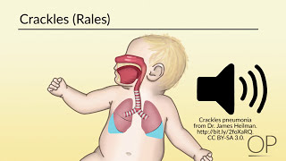 Respiratory Assessment by B Leary L DelSignore  OPENPediatrics [upl. by Steele]