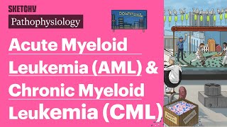 Acute Myeloid Leukemia AML amp Chronic Myeloid Leukemia CML Pathophysiology  Sketchy Medical [upl. by April]