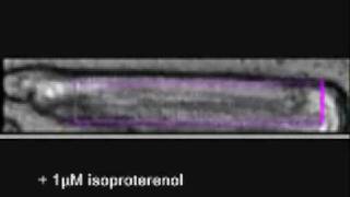 cardiac myocyte contractility [upl. by Ardnwahsal439]