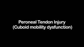 Peroneal Tendon Injury Cuboid mobility dysfunction [upl. by Adna]