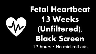 Fetal Heartbeat  13 Weeks Unfiltered 💓⬛ • 12 hours • No midroll ads [upl. by Letnom]