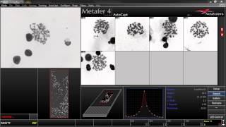 AutoCapt  Automated Image Acquisition with Metafer [upl. by Flyn]