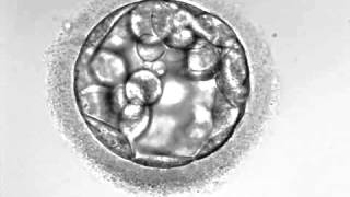 Development of hatching Embryo blastocyst stage [upl. by Adnil]