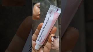 glocin gel review If you have any doubts of glocin gel check this clindamycin amp nicotinamide gel [upl. by Drawyeh]