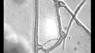 Anastomosis in mycorrhizal fungi [upl. by Eeleimaj422]