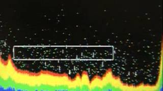 Sonar and ultrasound [upl. by Kannry]