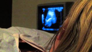 IVF diary  9  IVF the secret cycle  Embryo Transfer IVF [upl. by Palila]