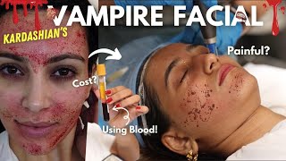 I tried the Vampire Facial 😱 Wait for the RESULTS  Aashi Adani [upl. by Fineman817]