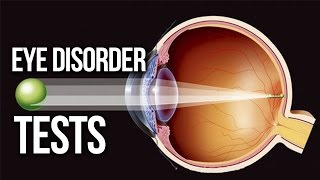 EYE DISORDER  Myopic Hyperopia Astigmatism TEST [upl. by Oznola]