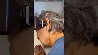 Grandmas Ear Pain Solved UnicFactx [upl. by Screens]