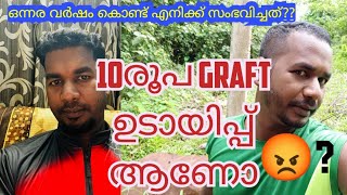 10രൂപ per graft വെറുമുടായിപ്പ് 😒ആണോ hair transplant 16year hair transplantresults [upl. by Aubrette843]