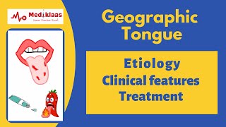 Geographic tongue Benign Migratory Glossitis [upl. by Aleakcim]