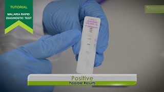 How to use a Malaria Rapid Diagnostic Test [upl. by Edualcnaej675]