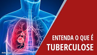 Entenda o que é Tuberculose [upl. by Llertrac]