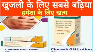 Clorash gm skin lotion and cream  Jittu ki clinic [upl. by Naro492]