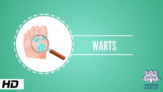 Wart Causes Signs and Symptoms Causes Diagnosis and Treatment [upl. by Yasnil]