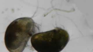 Ostracod live under the scope [upl. by Marchelle]