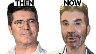 Simon Cowell NEW FACE  Plastic Surgery Analysis [upl. by Novelc958]