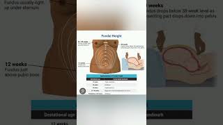 Fundal height measurement education ministryofhealth publicawareness viralshorts [upl. by Yelraf19]