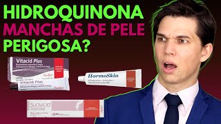 HIDROQUINONA para MANCHAS de Pele COMO USAR Clareadores Suavicid Hormoskin Vitacid Plus [upl. by Amabel]