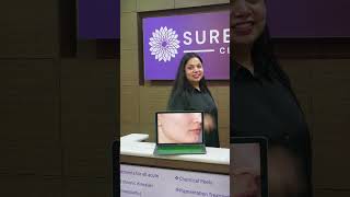 Even You Can Also Get Rid Of Acne  📞 7678265141 Surecure Clinic  Dr Suchita [upl. by Ailina711]