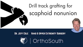 Scaphoid Nonunion Drill Track GraftingDr Jeff ColeOrthoSouth [upl. by Sedrul]