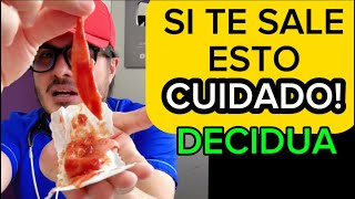 Endometriosis síntomas y tratamiento  Reacción Decidual Endometrial [upl. by Yarb572]