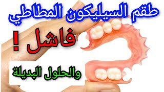 طقم الأسنان المطاطي المرن السيليكون فاشل ❗️إليكم البديل prothèse dentaire amovible Flexible [upl. by Abelard]