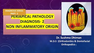 Periapical Pathology  Non inflammatory and non odontogenic lesions [upl. by Luba]