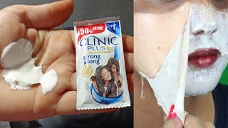 ACNE TREATMENT VU QUYNH MI  Blackheads On Boy Chin 2024FULL [upl. by Donovan]