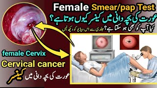 pap smearpap Test performedcervical cancer in females uteruspower [upl. by Helfant]